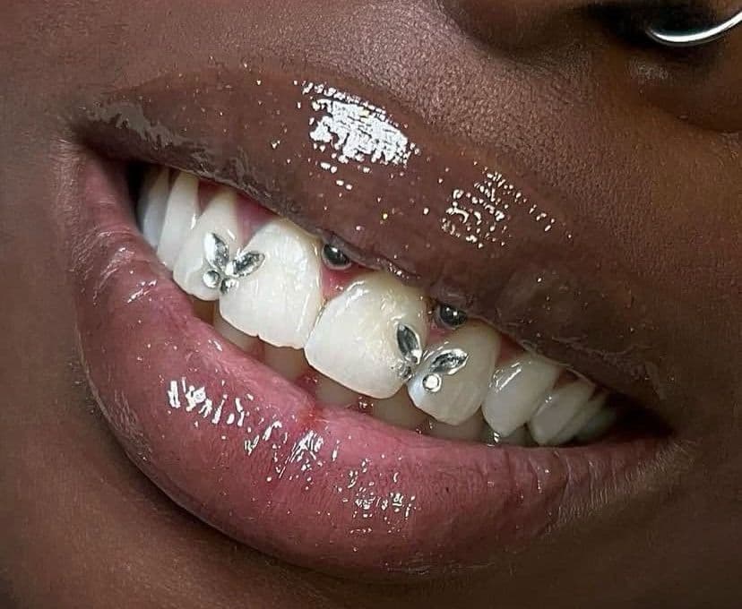 Tooth Gem Application